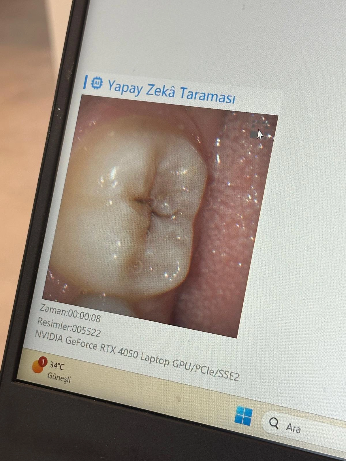 dentalpin-diş-aletleri-20