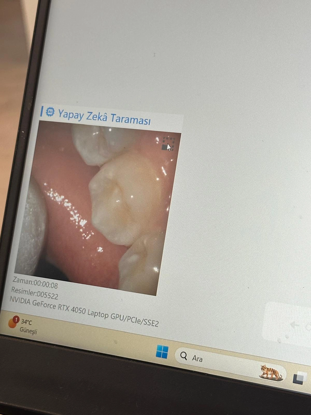 dentalpin-diş-aletleri-22