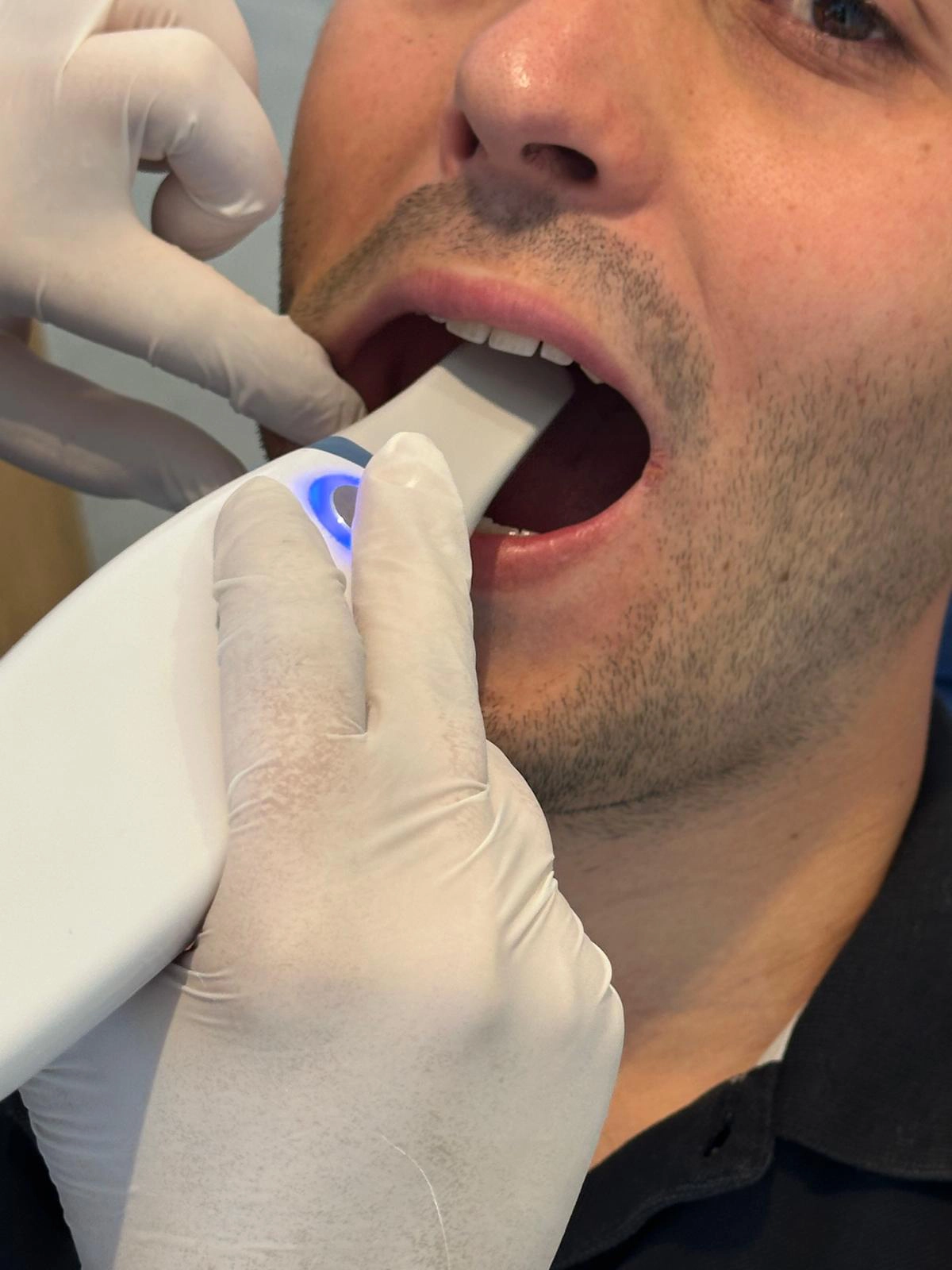 dentalpin-diş-aletleri-24