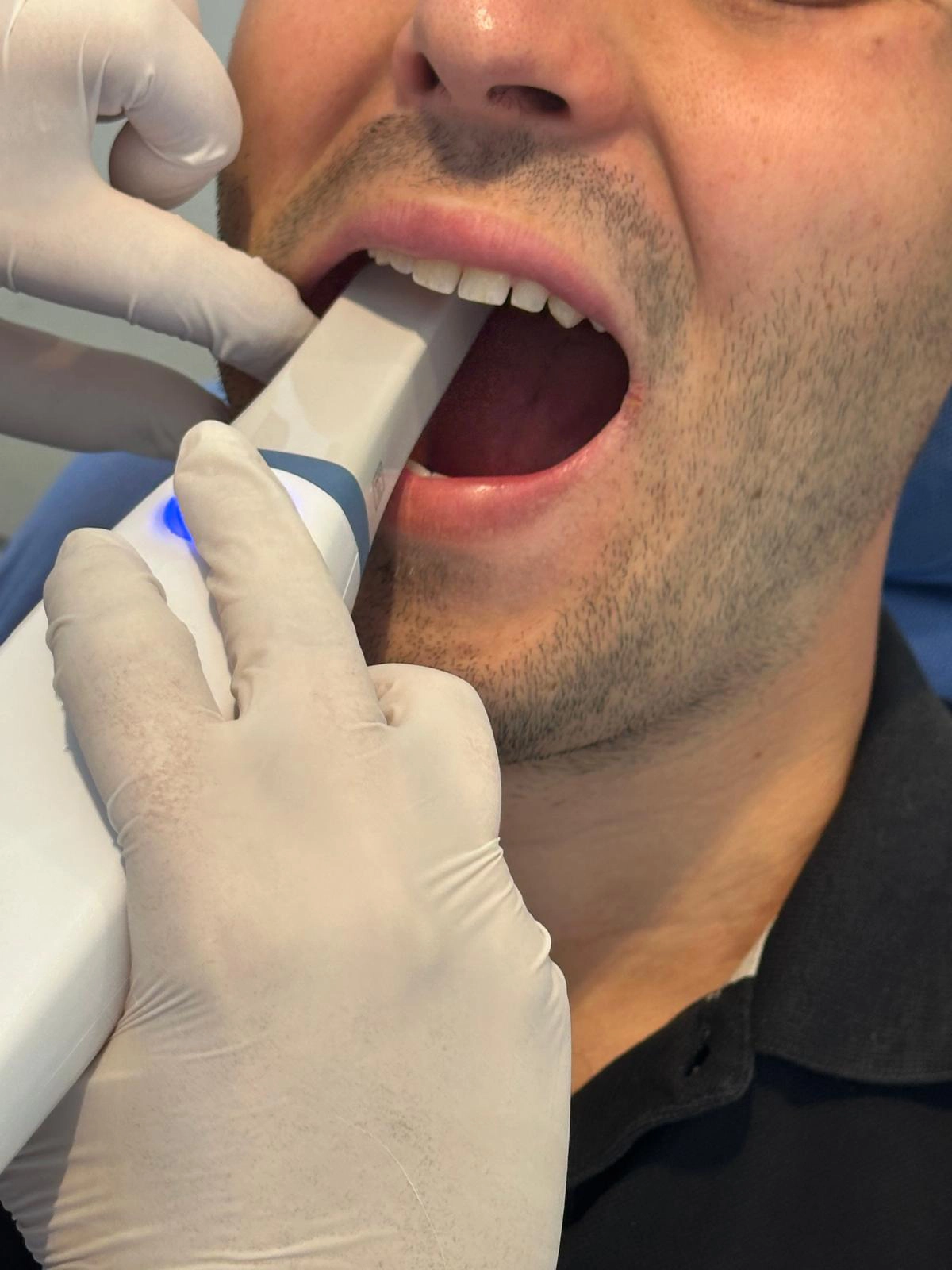 dentalpin-diş-aletleri-25